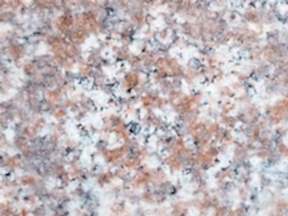 Coralmistindia Granit | Mutfak Tezgahi Ankara